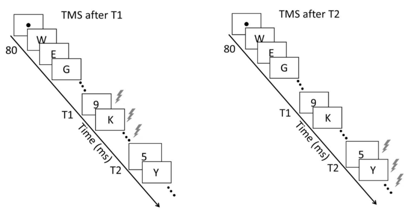 rTMS實(shí)驗(yàn)刺激及流程示意圖